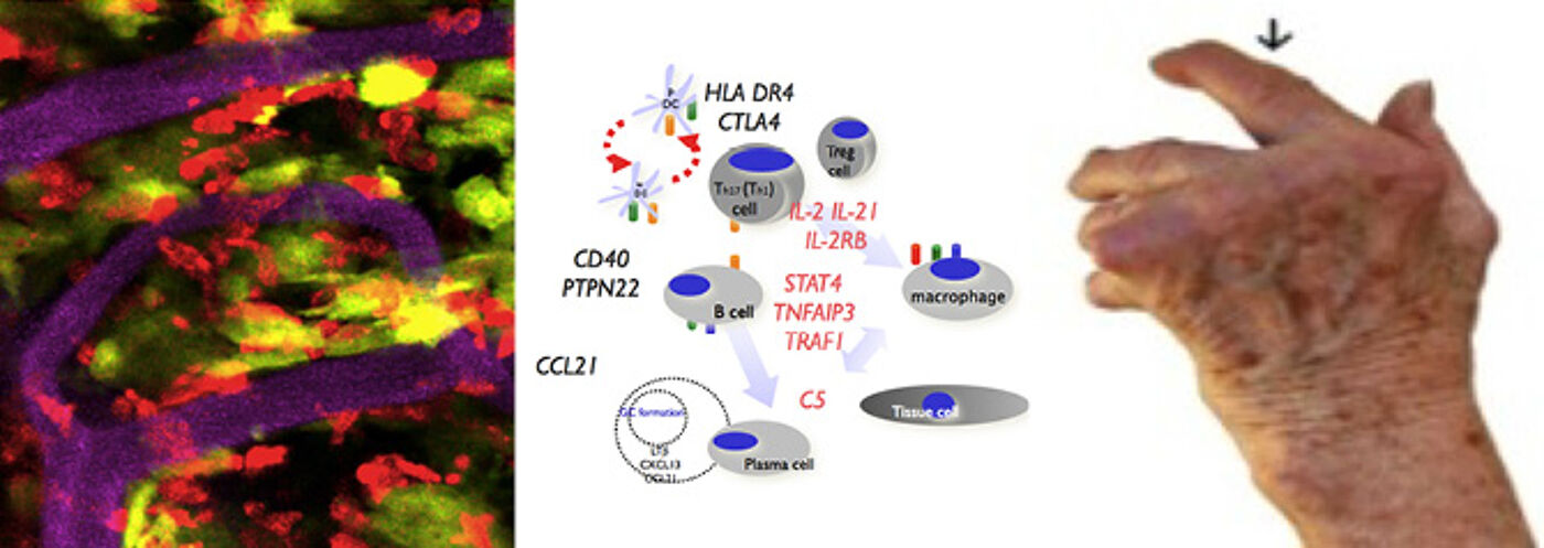 Immunology and Inflammatory Disesase banner