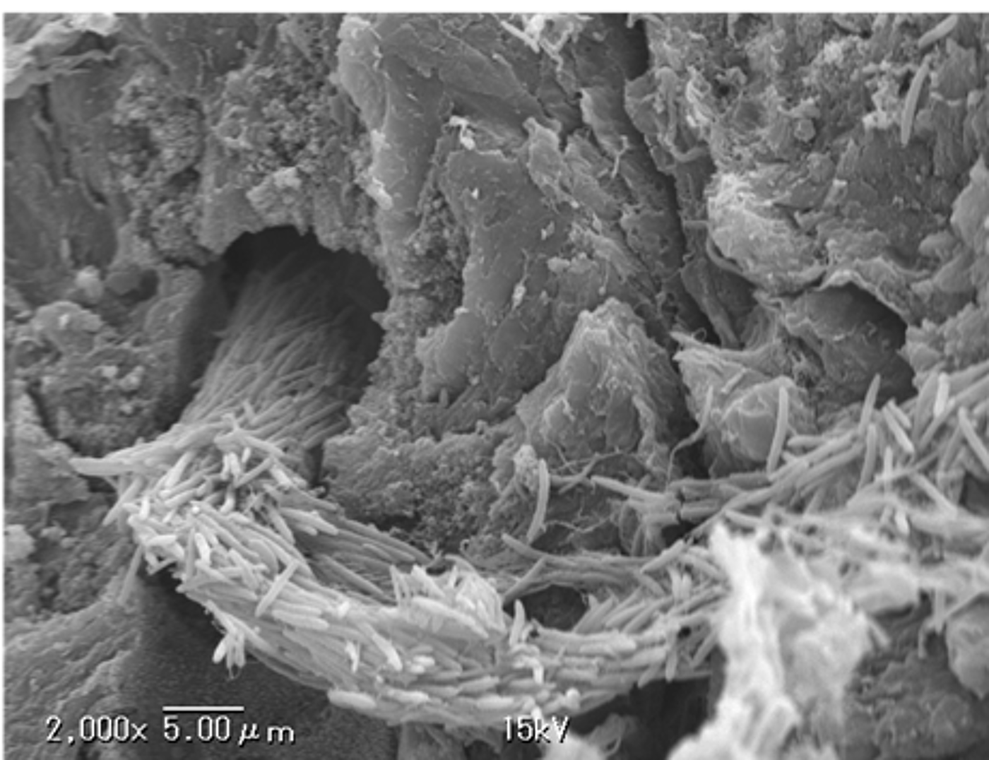 SEM of a colon tumour showing large extracellular, but intra-tumoural, Salmonella colonies.