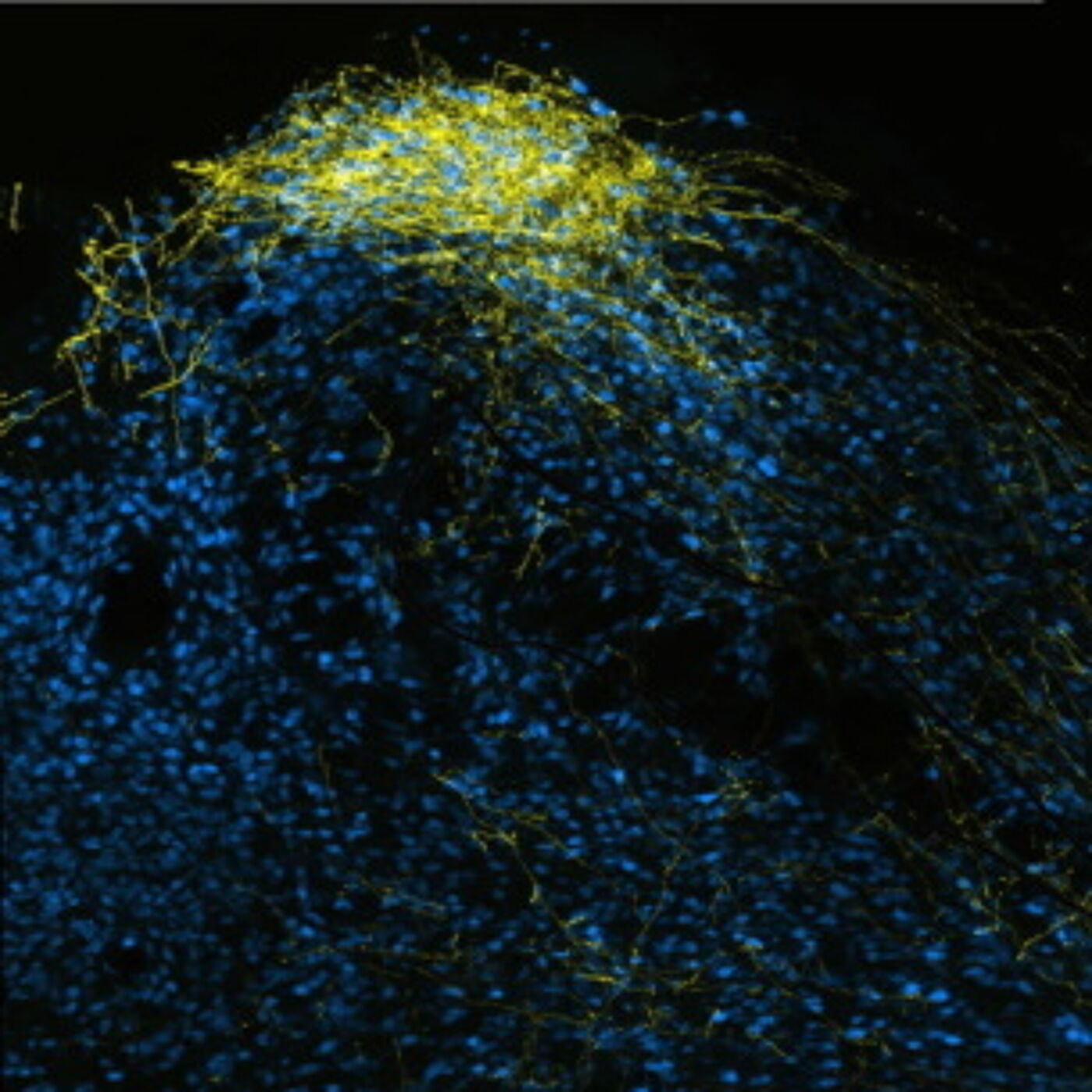 Micrograph of fluorescently labelled neurons