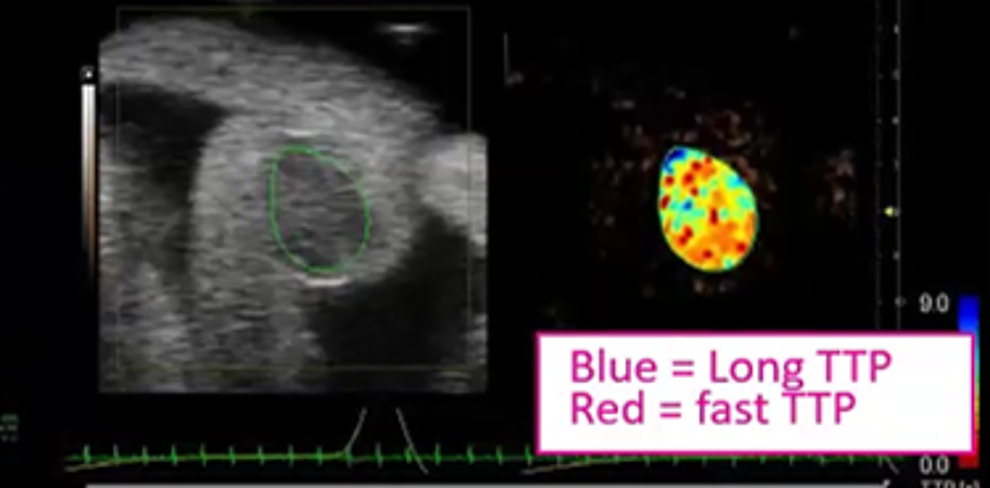 Ultrasound image