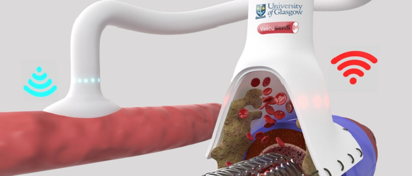 Graphic showing new smart vascular stents