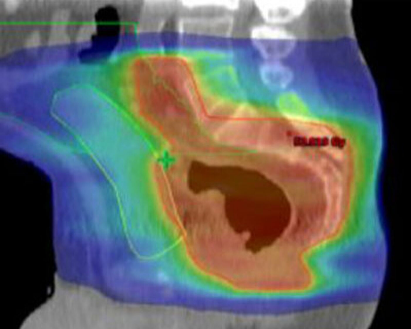 This picture shows a thermal scan