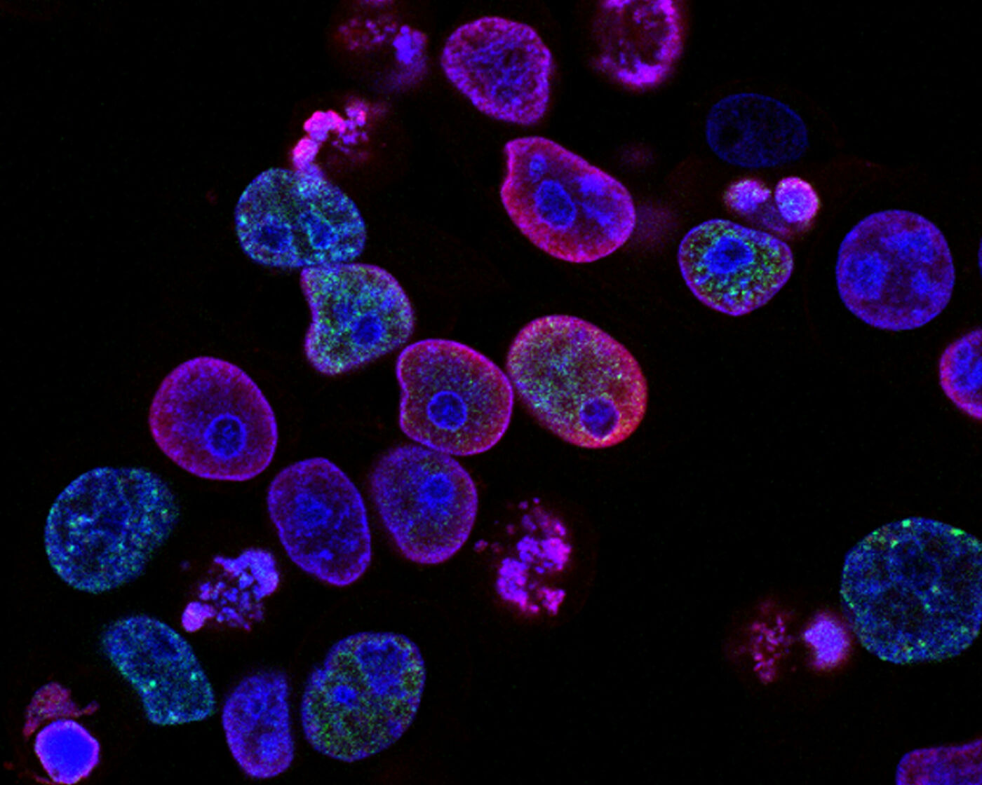 This picture is from the Cancer Institute and shows pink and blue cells under a microscope