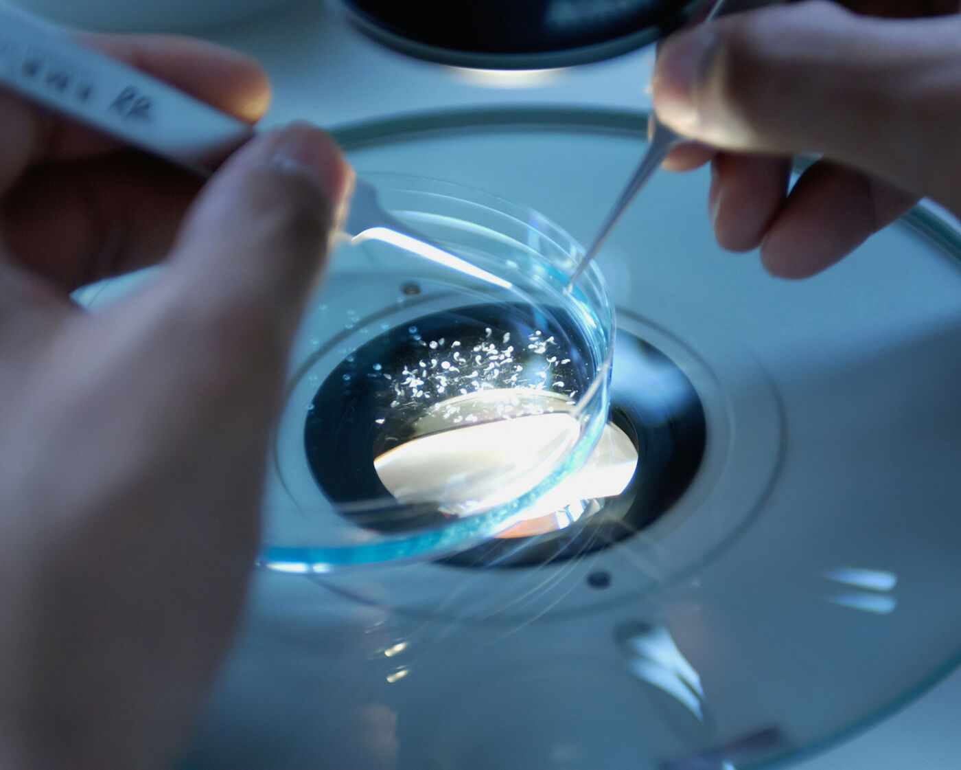 The hands of a scientist using forceps to extract chorion from Zebrafish embryos.