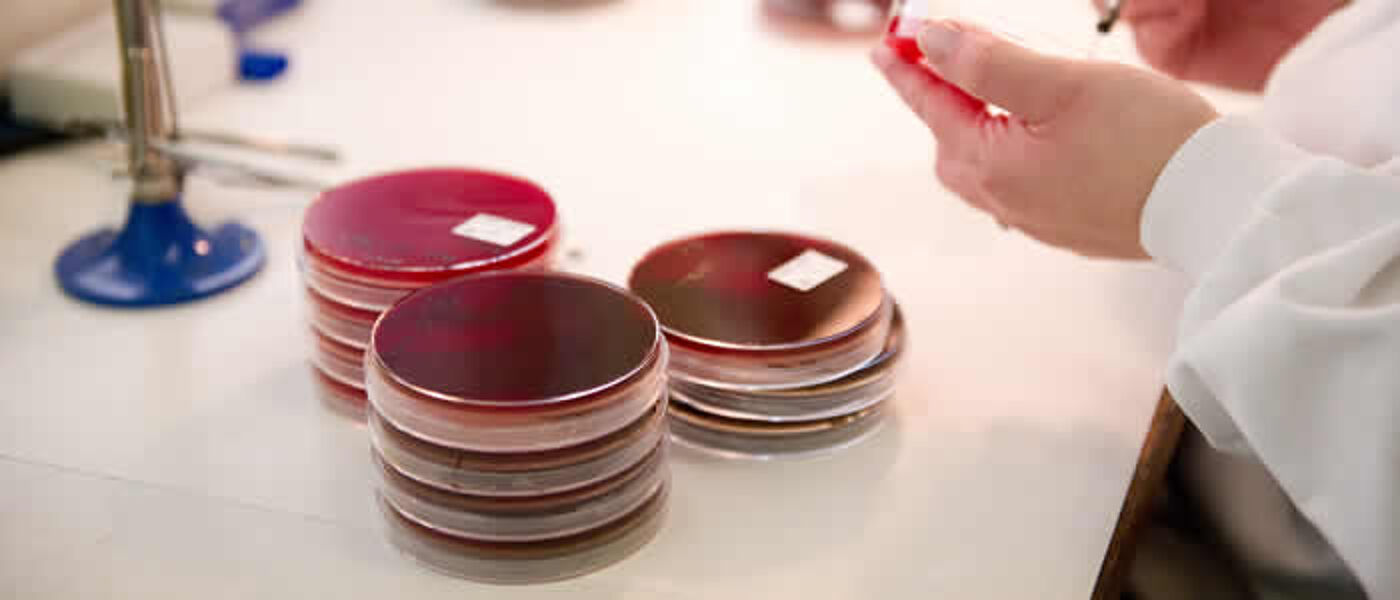 horizontal banner showing petri dishes in lab