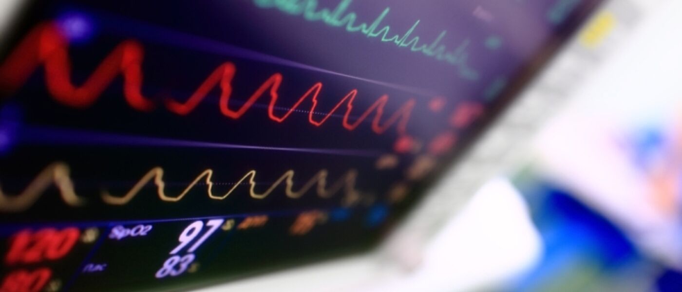 Image of a heart monitor
