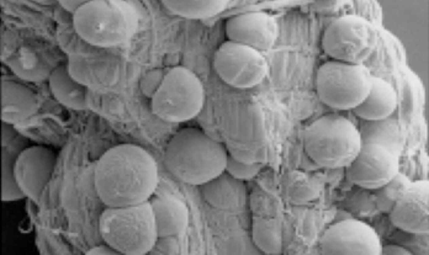 2- Vector-pathogen interactions - tile