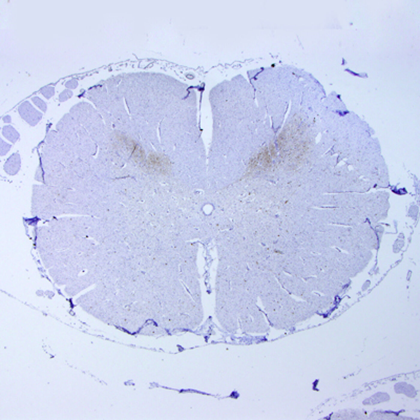 Section through an SBV infected spinal cord