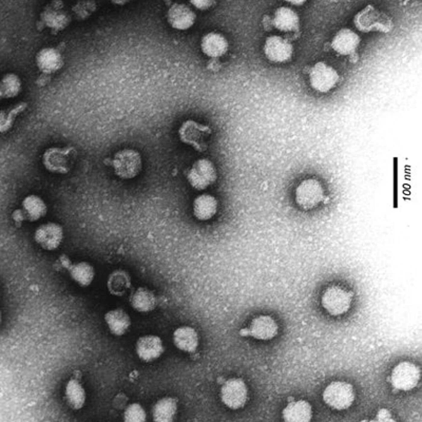 Semliki forest virus. From Wikimedia Commons CC-BY-SA-2.0-DE