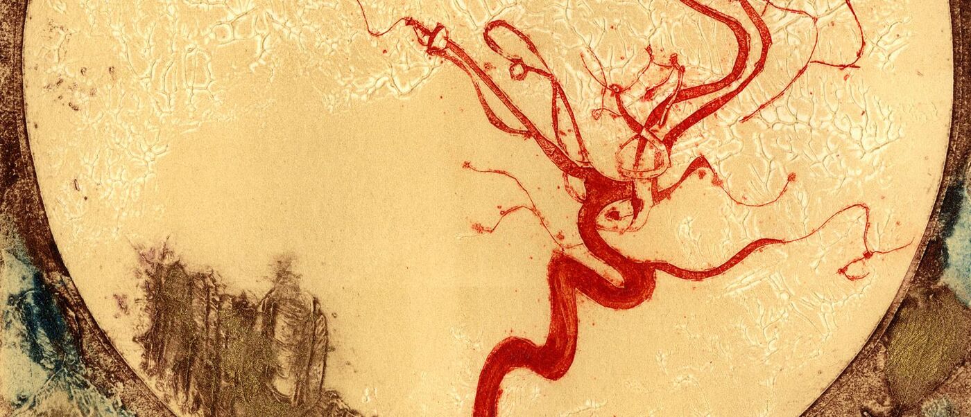 Between a Thing and a Thought, artwork by Susan Aldworth