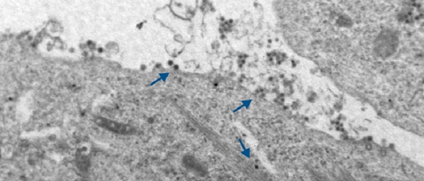 Bluetongue virus BTV electronmicrograph