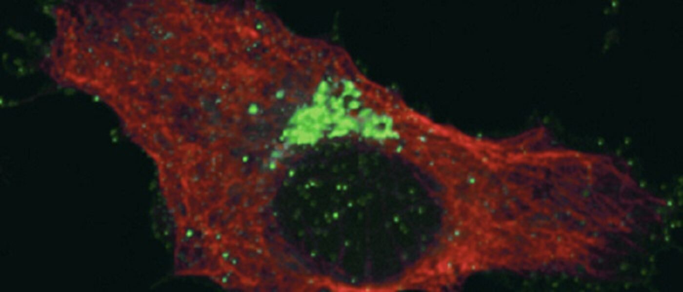 Fluorescently labelled Bunyamwera viral proteins viewed by confocal microscopy