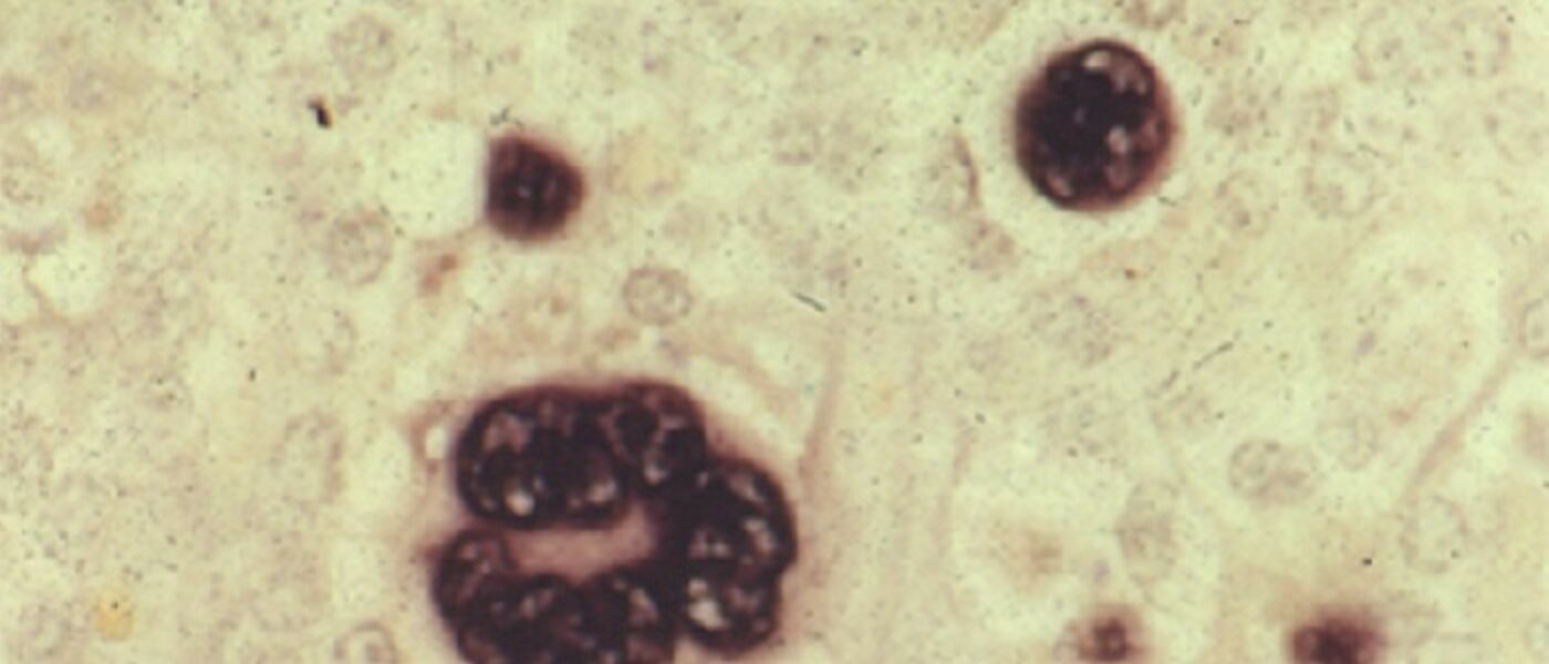 Epstein Barr Virus cells