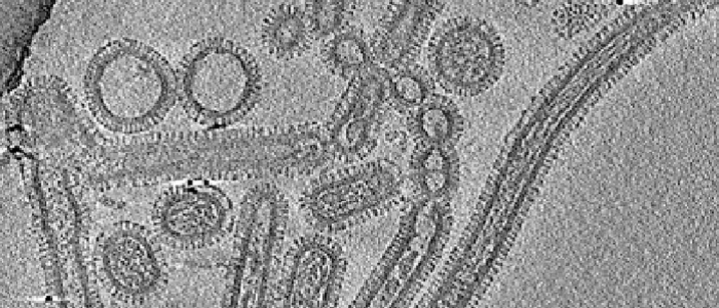 Influenza A virus tomogram 