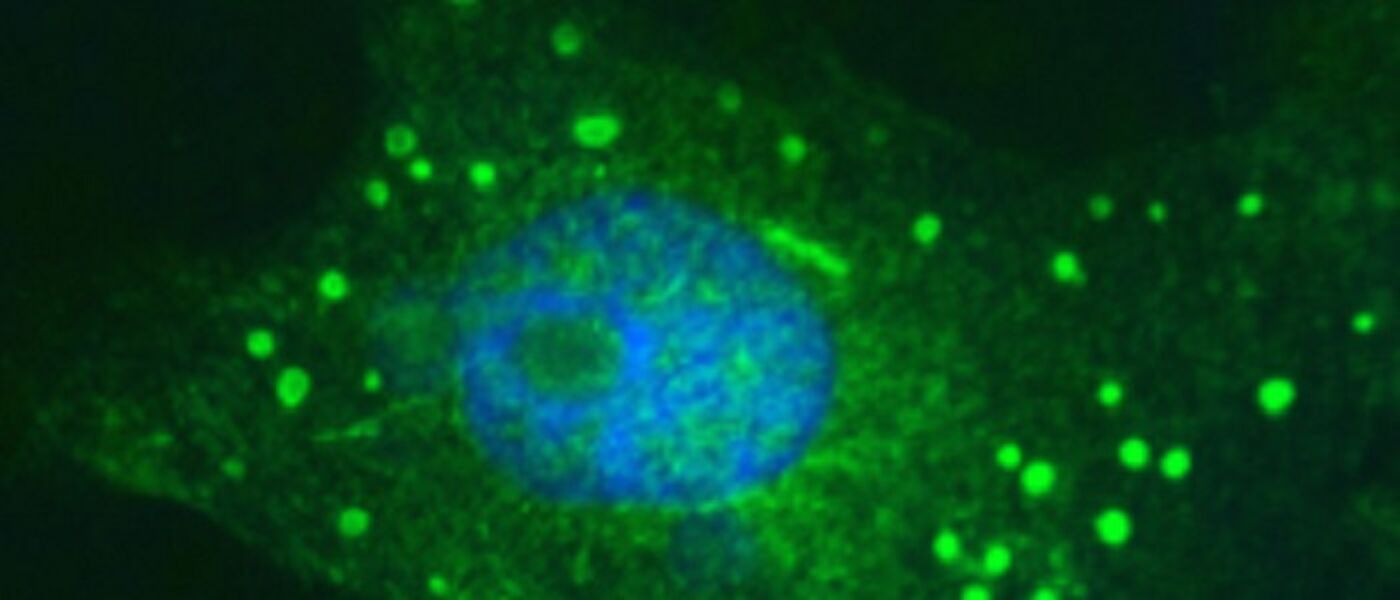 Severe fever with thrombocytopenia syndrome virus 