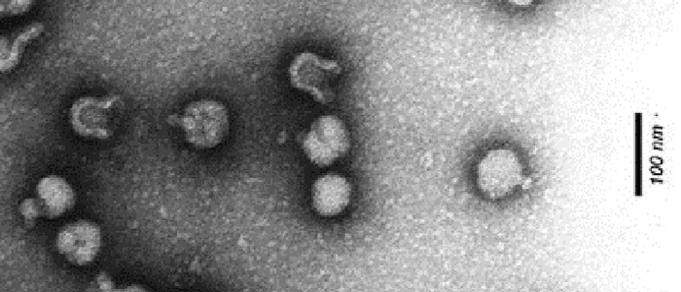Semliki forest virus. From Wikimedia Commons CC-BY-SA-2.0-DE 