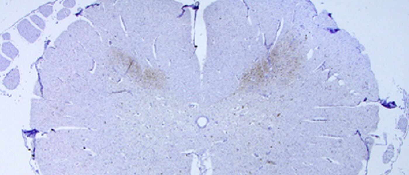 Schmallenberg Spinal section