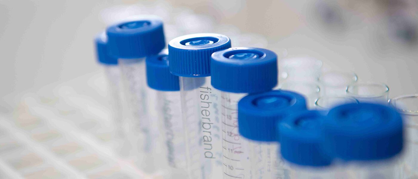 Photo of sample vials with blue lids