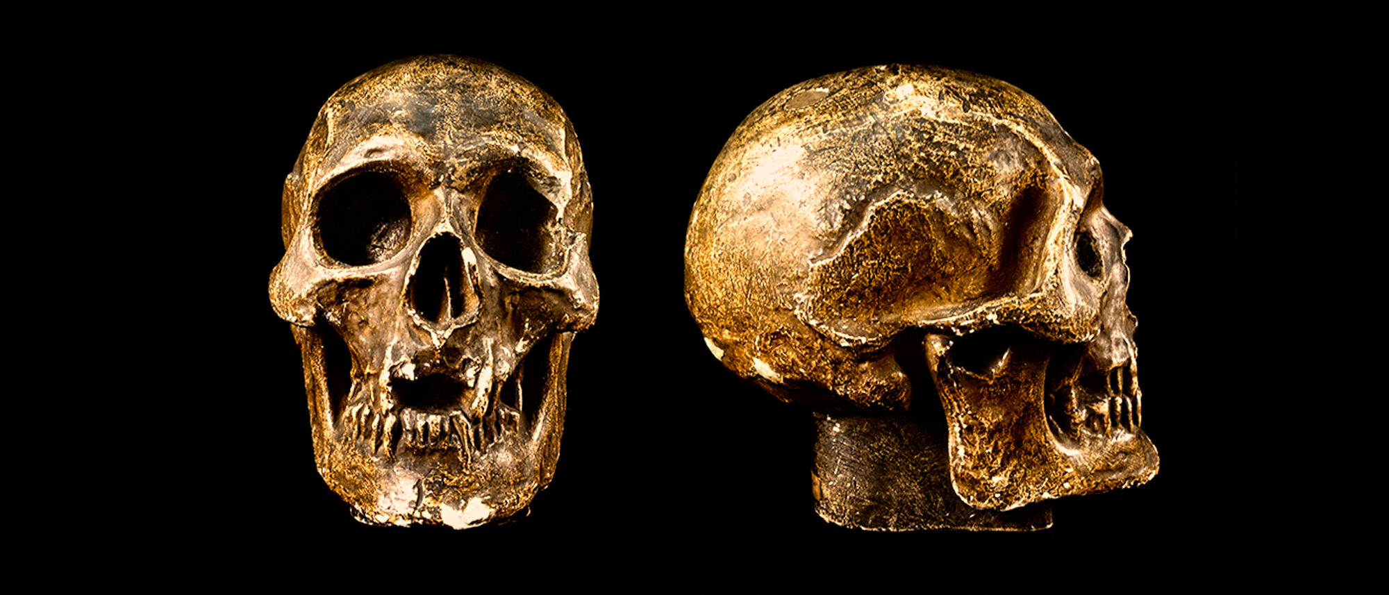 Cast of the skull of Robert the Bruce