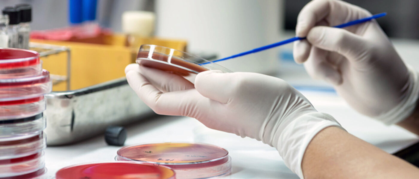 Photo of person working in lab with petri dishes
