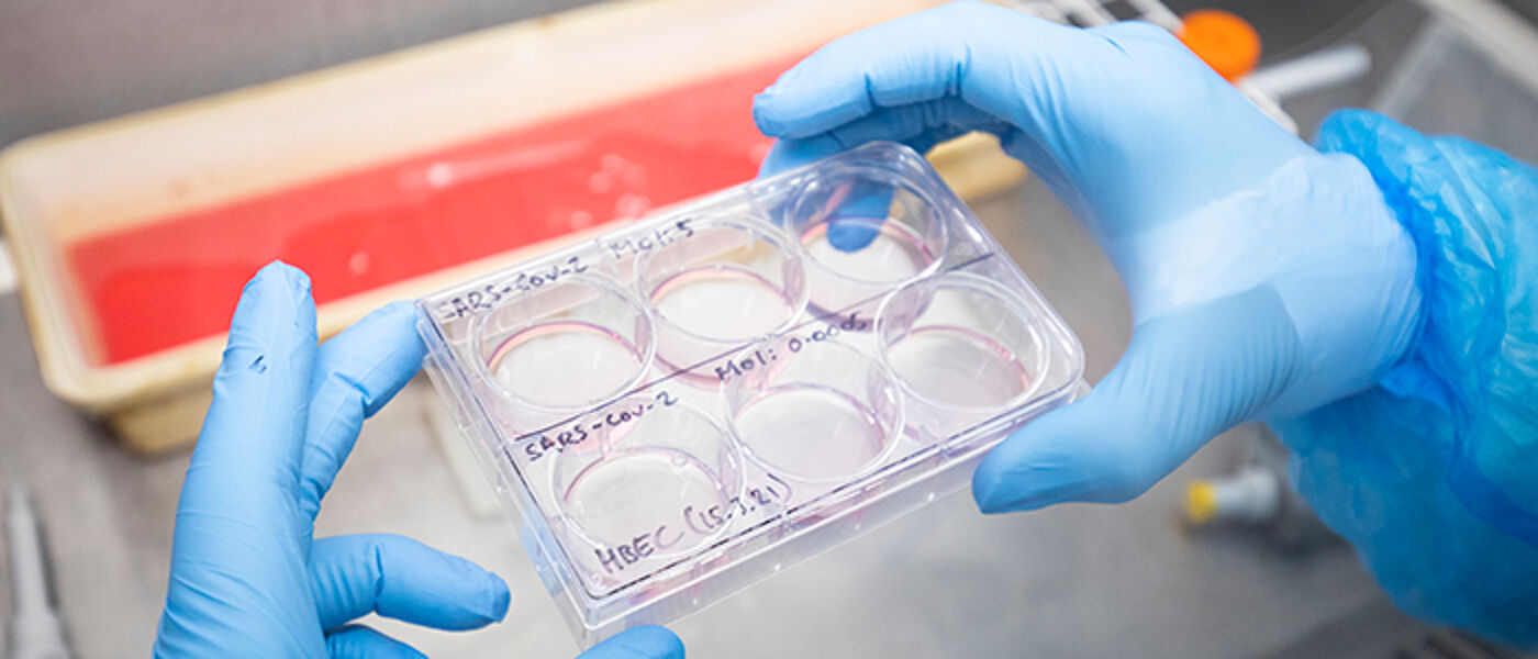 A picture of someone holding a 6 well plate with SARS-CoV-2 cells being treated with different drugs. 
