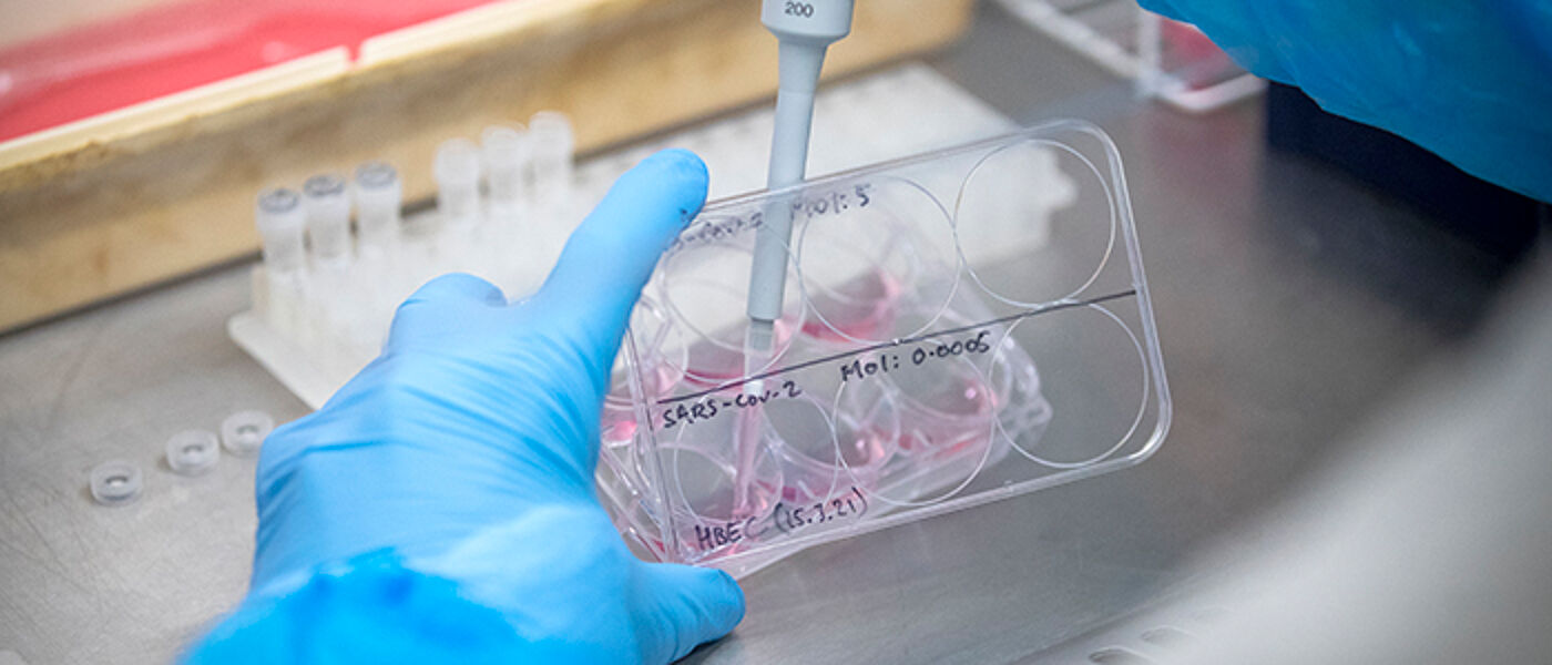 Picture of someone pipetting from a 6 well plate