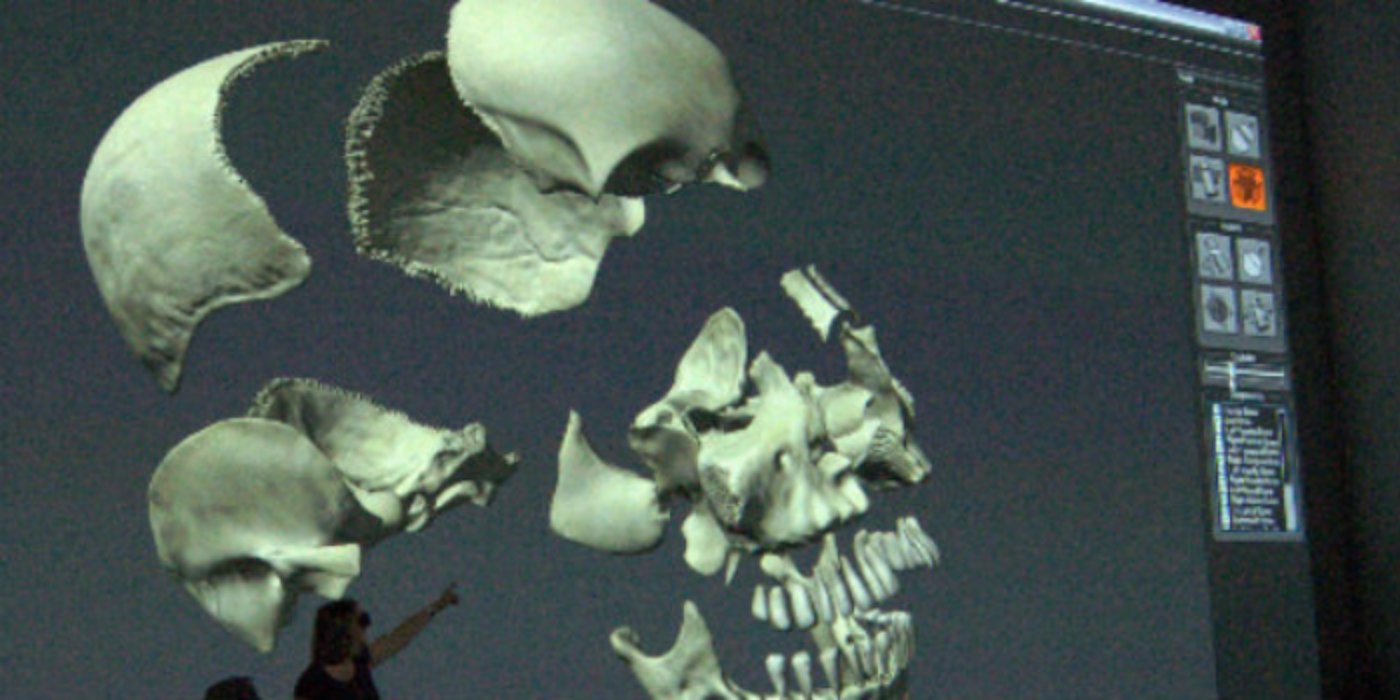 A deconstructed skull depicted on anatomy software on a computer screen