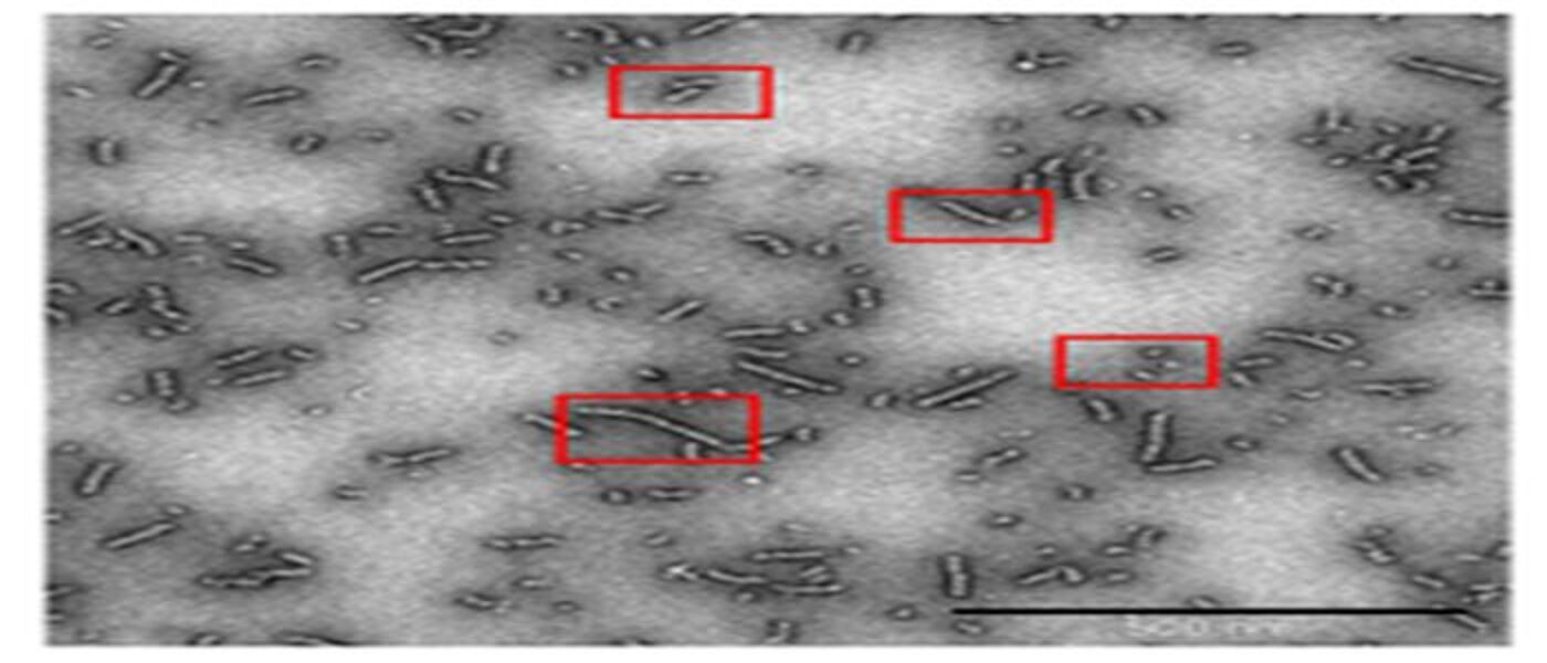 Image of Bacteria under a microscope